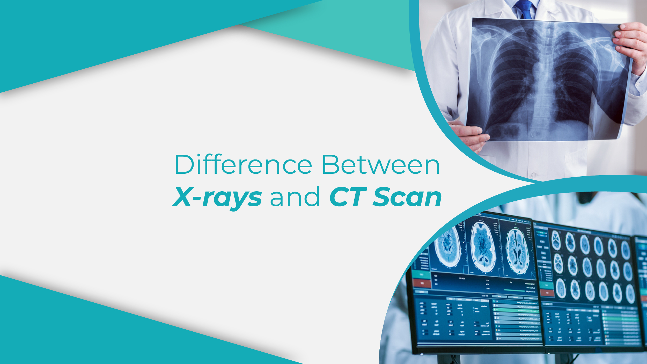 Difference between X-rays and CT scans